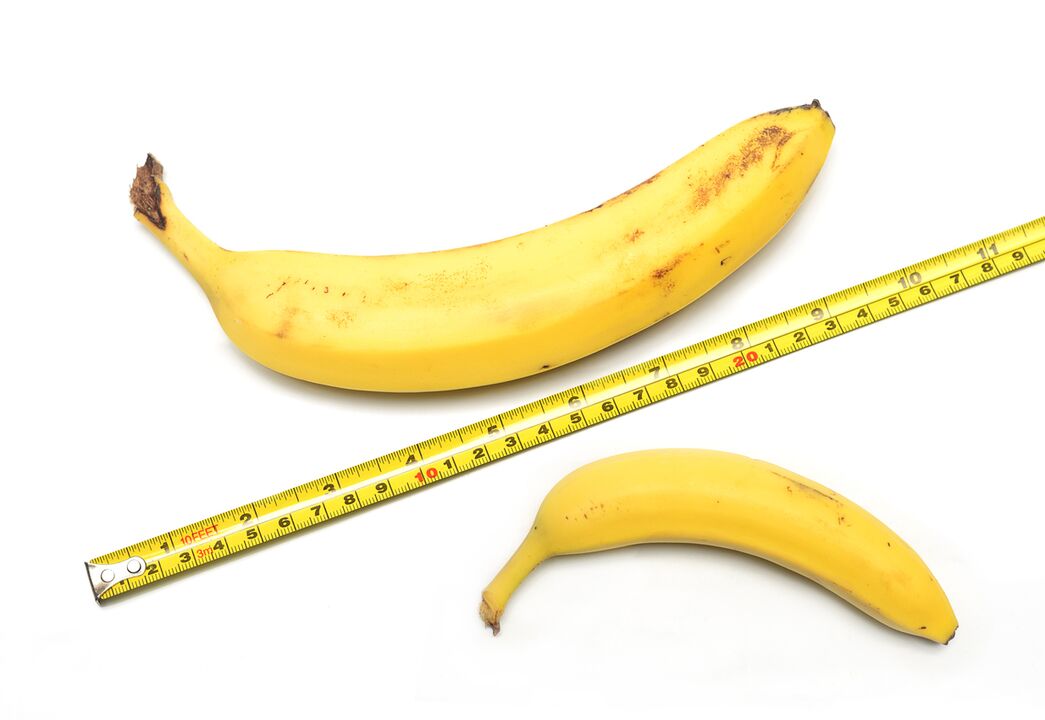 Пеш аз ва пас аз усулҳои васеъ кардани penis